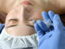 成型前に麻酔注射をされている女性